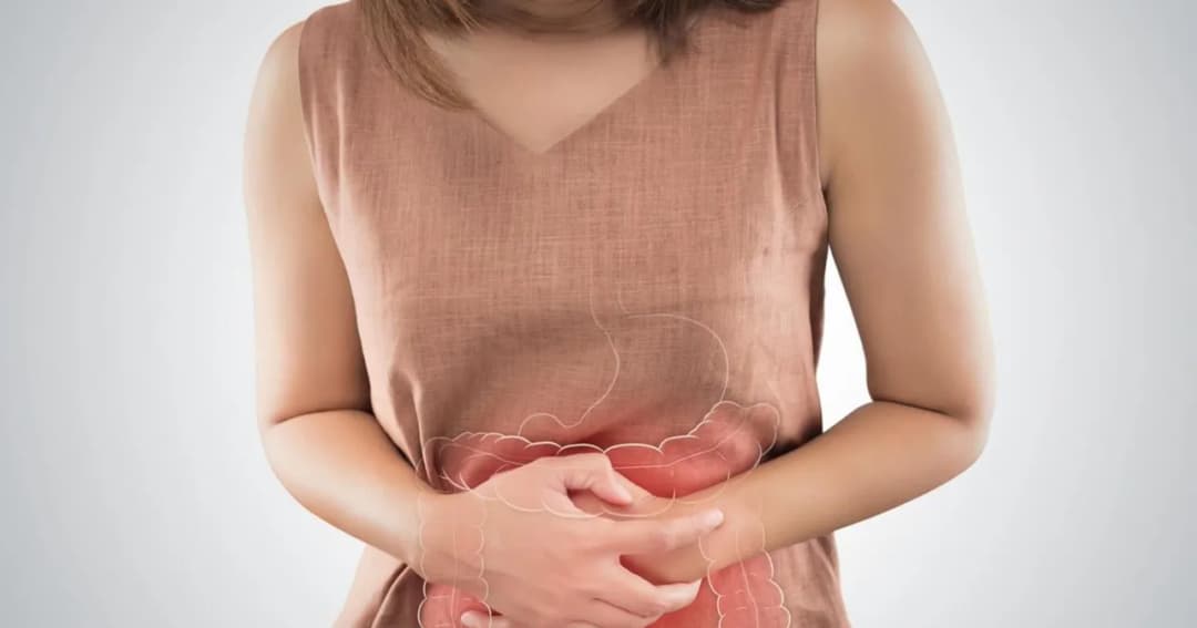 Ircolon kiedy zażywać: kluczowe informacje o dawkowaniu i posiłkach