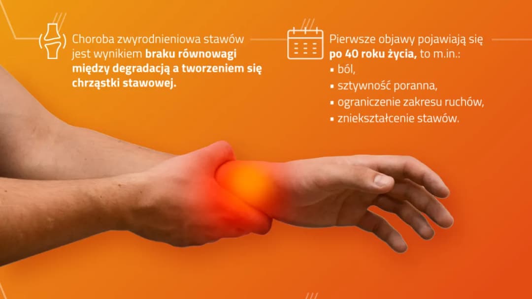 Zwyrodnienie stawów rąk do jakiego lekarza? Kluczowe informacje dla Ciebie