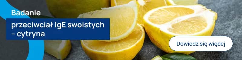 Czy cytryna uczula? Objawy alergii, których musisz się wystrzegać