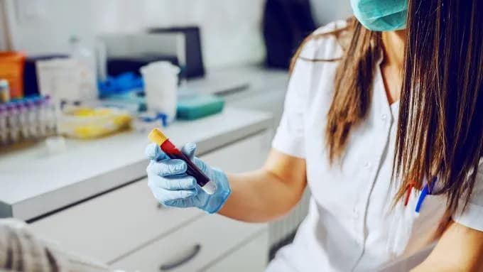 Czy mogę wypić kawę przed badaniem krwi? Sprawdź skutki dla wyników