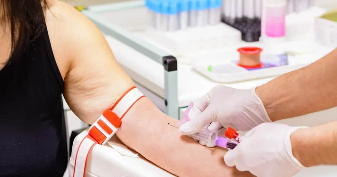 Ile na czczo przed badaniem glukozy? Ważne zasady, które musisz znać