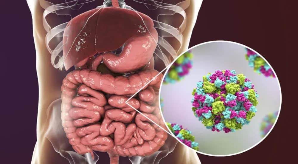 Objawy jelitówki u dorosłych – jak rozpoznać i złagodzić nieprzyjemne dolegliwości