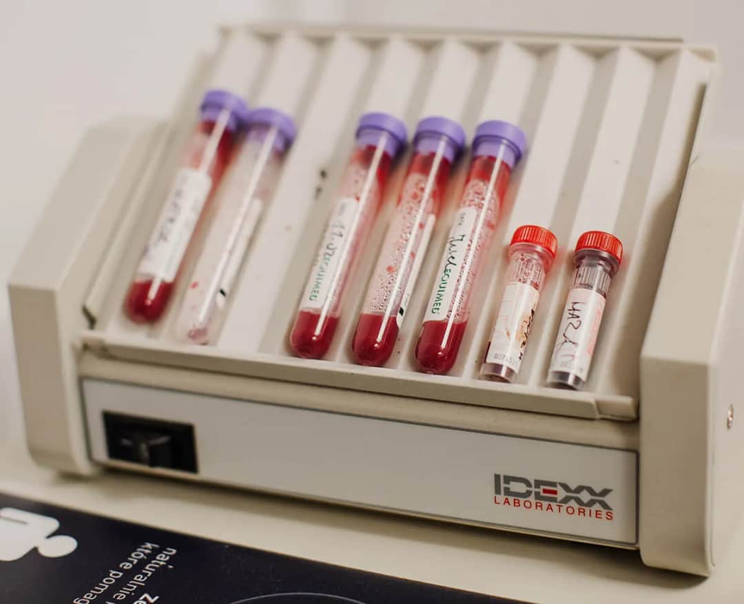 Czego unikać przed badaniem krwi, aby wyniki były wiarygodne i dokładne