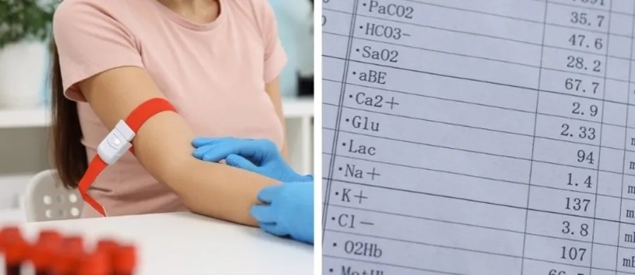 Jakie badania krwi przed wizytą u urologa mogą uratować Twoje zdrowie