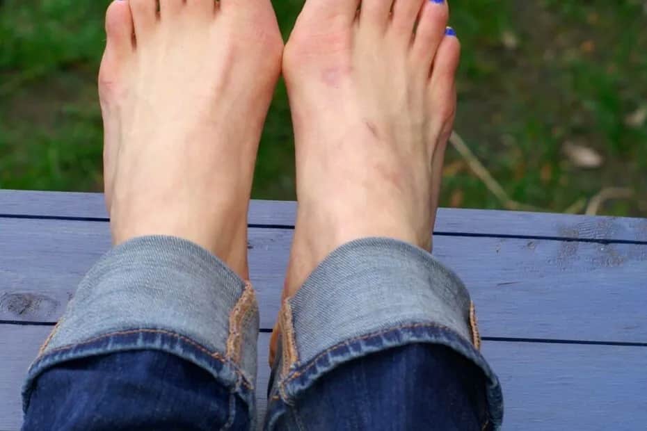 Jak złagodzić ból haluksa? Skuteczne metody i porady