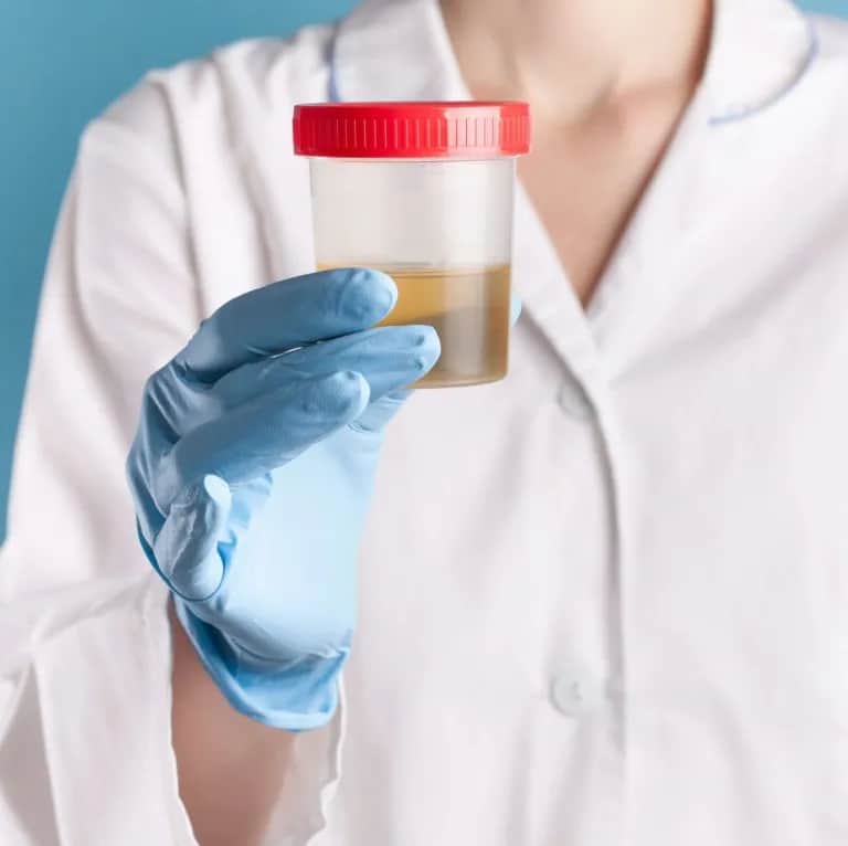 Czego nie robić przed badaniem moczu, aby wyniki były wiarygodne