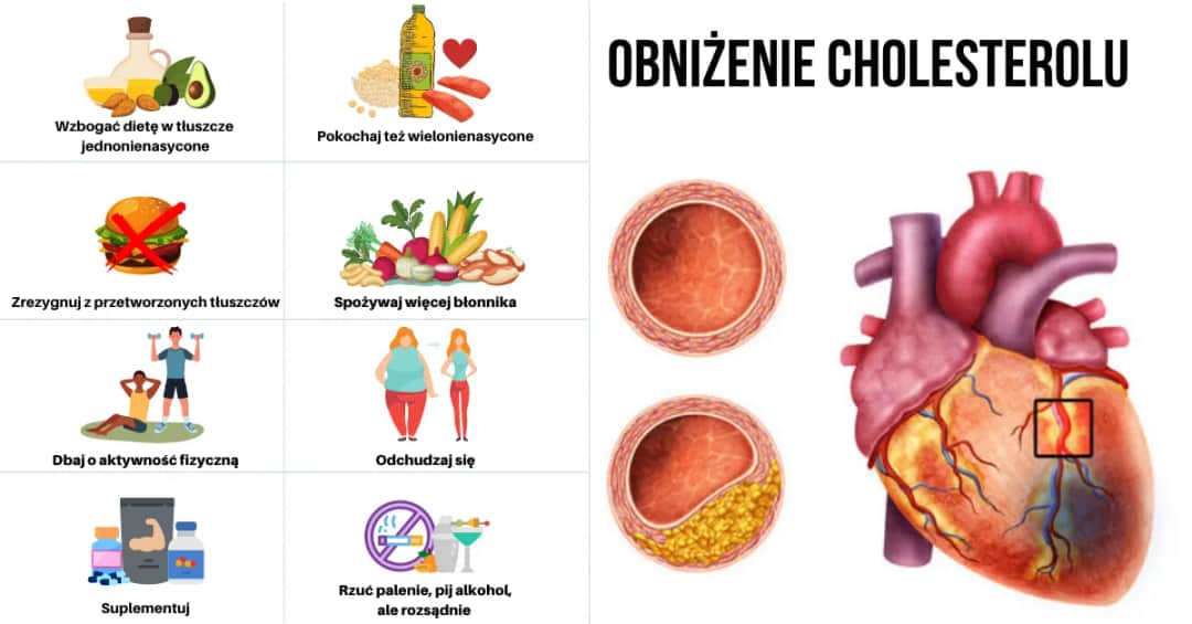 Jak szybko obniżyć cholesterol przed badaniem krwi – skuteczne metody w krótkim czasie