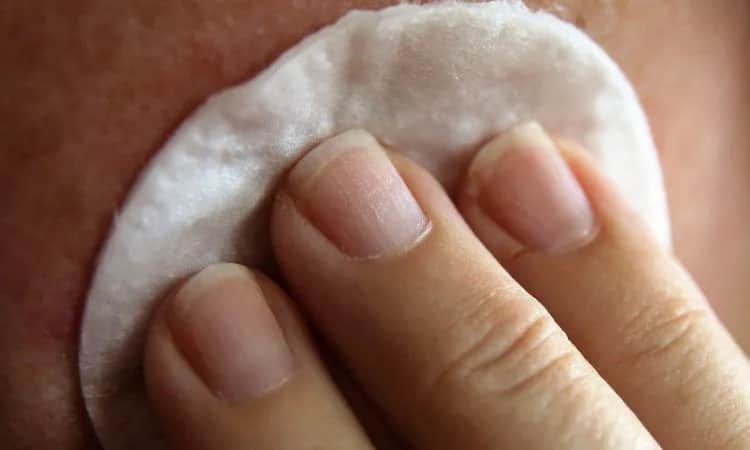 Jak zapobiec rozstępom: Skuteczne metody na piękną skórę