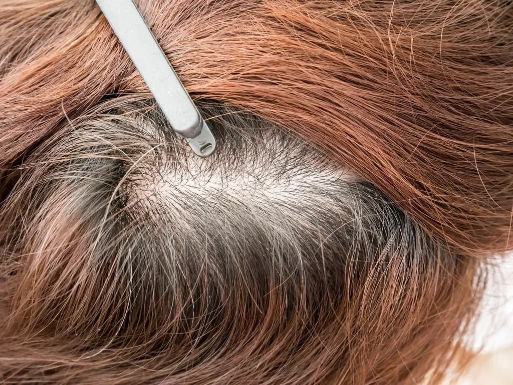 Jak zapobiec siwieniu włosów: skuteczne metody i zmiany w diecie