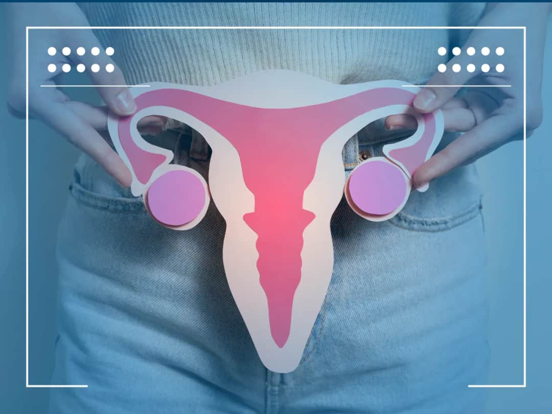 Torbiel na jajniku: objawy i ból pleców, które musisz znać