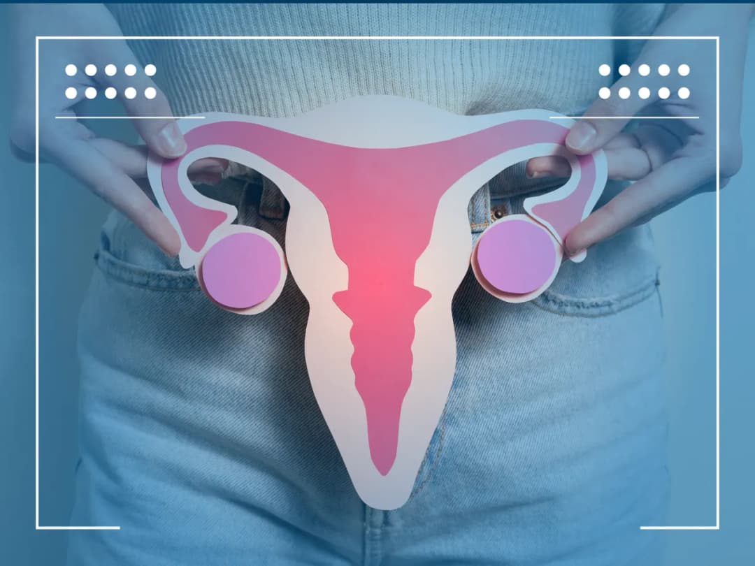 Torbiel na jajniku: objawy i ból pleców, które musisz znać