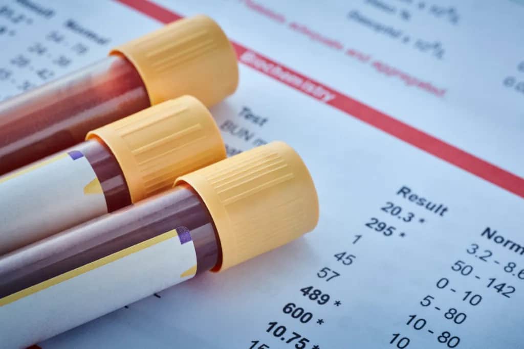 Kiedy odstawić żelazo przed badaniem krwi, aby wyniki były prawidłowe?