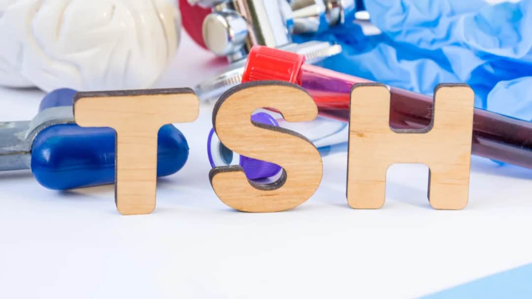 Czy można pić kawę przed badaniem TSH? Sprawdź, co musisz wiedzieć