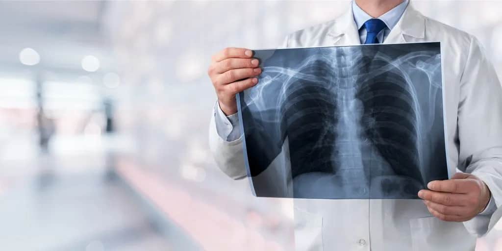 Jak rozpoznać objawy obrzęku płuc i kiedy szukać pomocy?