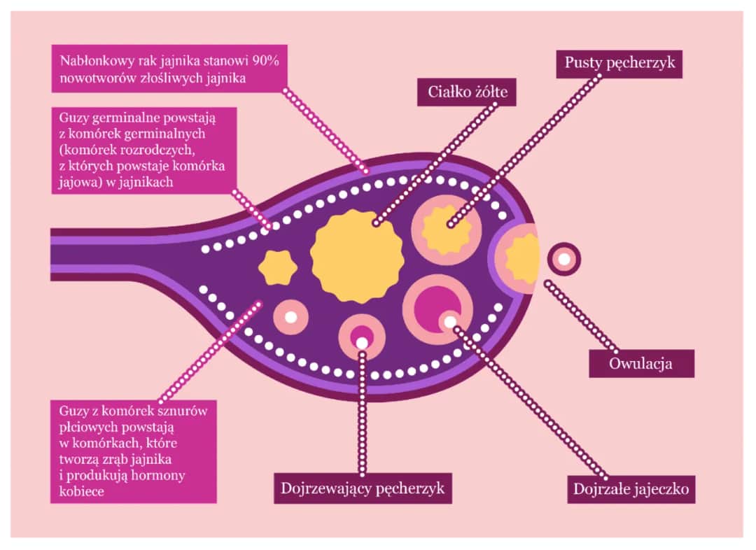 Rak narządów rodnych objawy – niebagatelne sygnały, które mogą zaskoczyć